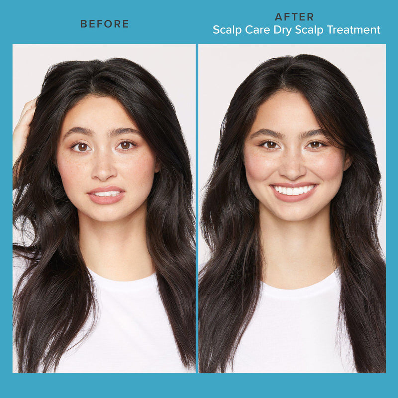 Scalp Care Dry Scalp Treatment-TREATMENT-Hairsense